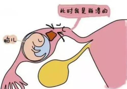 二代試管嬰兒成功率高不高？