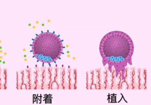 俄羅斯試管哪里好篩查費用多少？?