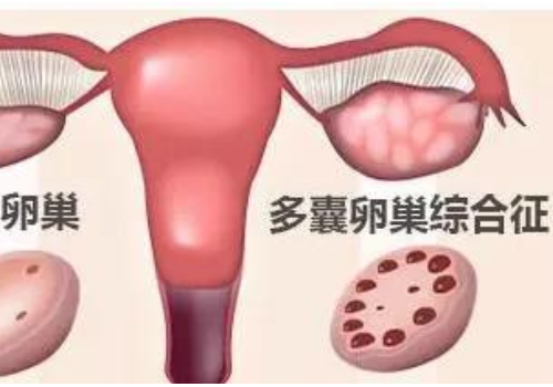 俄羅斯試管技術(shù)服務(wù)優(yōu)勢？?